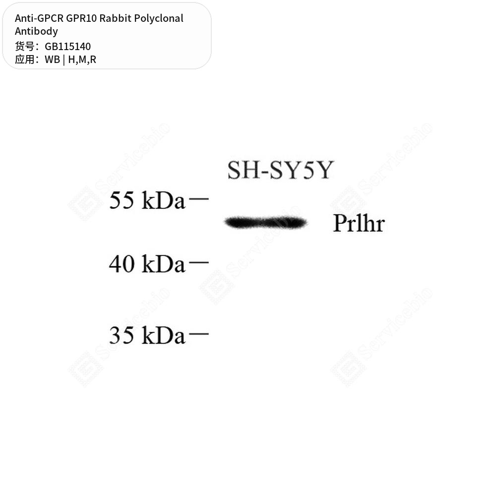 Антитела первичные, поликлональные кролика к GPCR GPR10 крысы, мыши, человека, 100 мкл