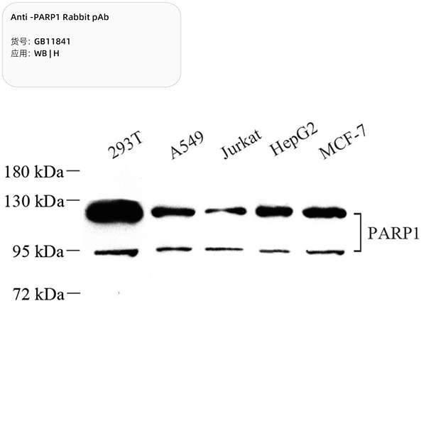 Антитела первичные, поликлональные, PARP1, 100 мкл