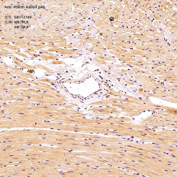 Антитела первичные, поликлональные, PSKH1, 100 мкл