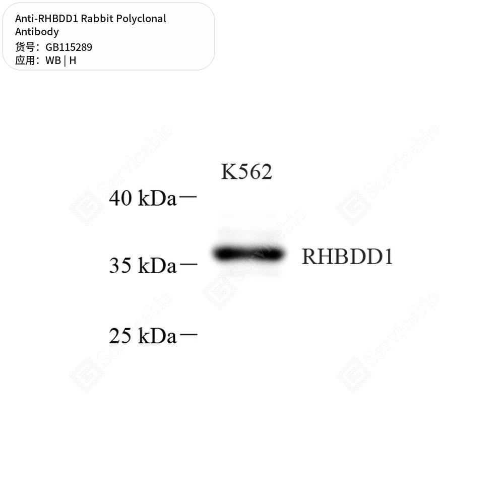 Антитела первичные, поликлональные кролика к RHBDD1 человека, 50 мкл