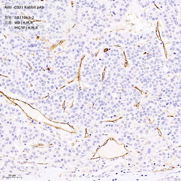 Антитела первичные, поликлональные CD31, 100 мкл