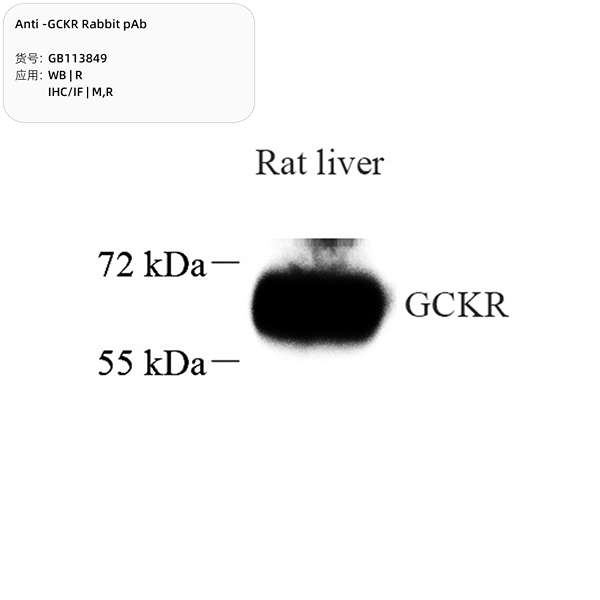 Антитела первичные, поликлональные, GCKR, 100 мкл