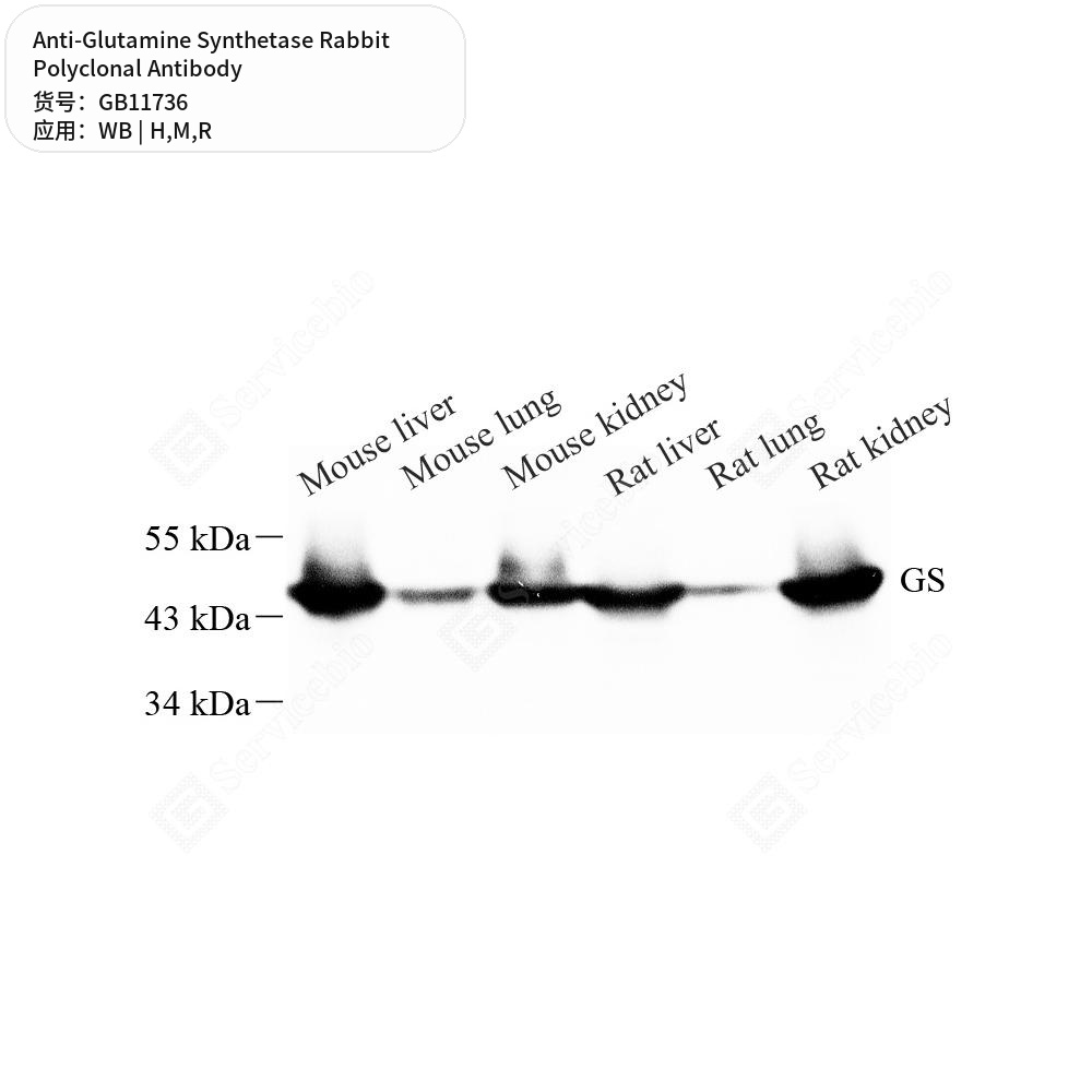 Антитела первичные, поликлональные кролика к Glutamine Synthetase крысы, мыши, человека, 50 мкл