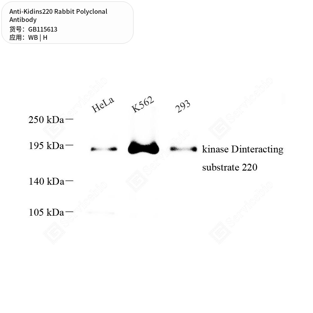 Антитела первичные, поликлональные кролика к Kidins220 человека, 100 мкл