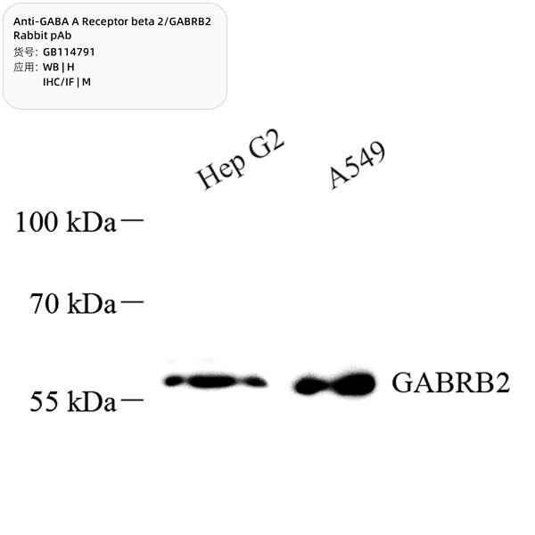 Антитела первичные, поликлональные, GABA A Receptor beta 2/GABRB2, 100 мкл