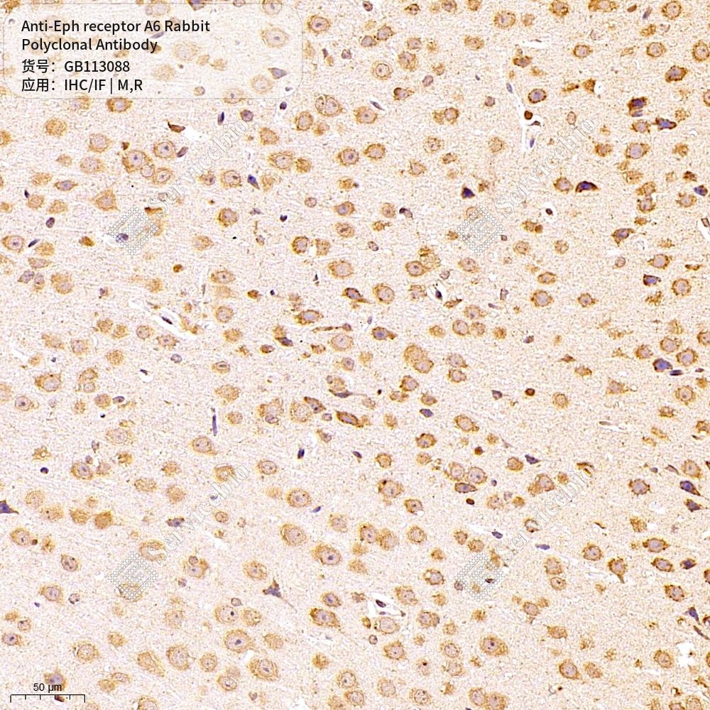 Антитела первичные, поликлональные кролика к Eph receptor A6 крысы, мыши, 50 мкл
