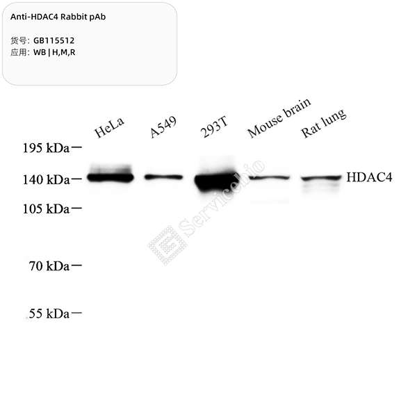 Антитела первичные, поликлональные, HDAC4, 100 мкл