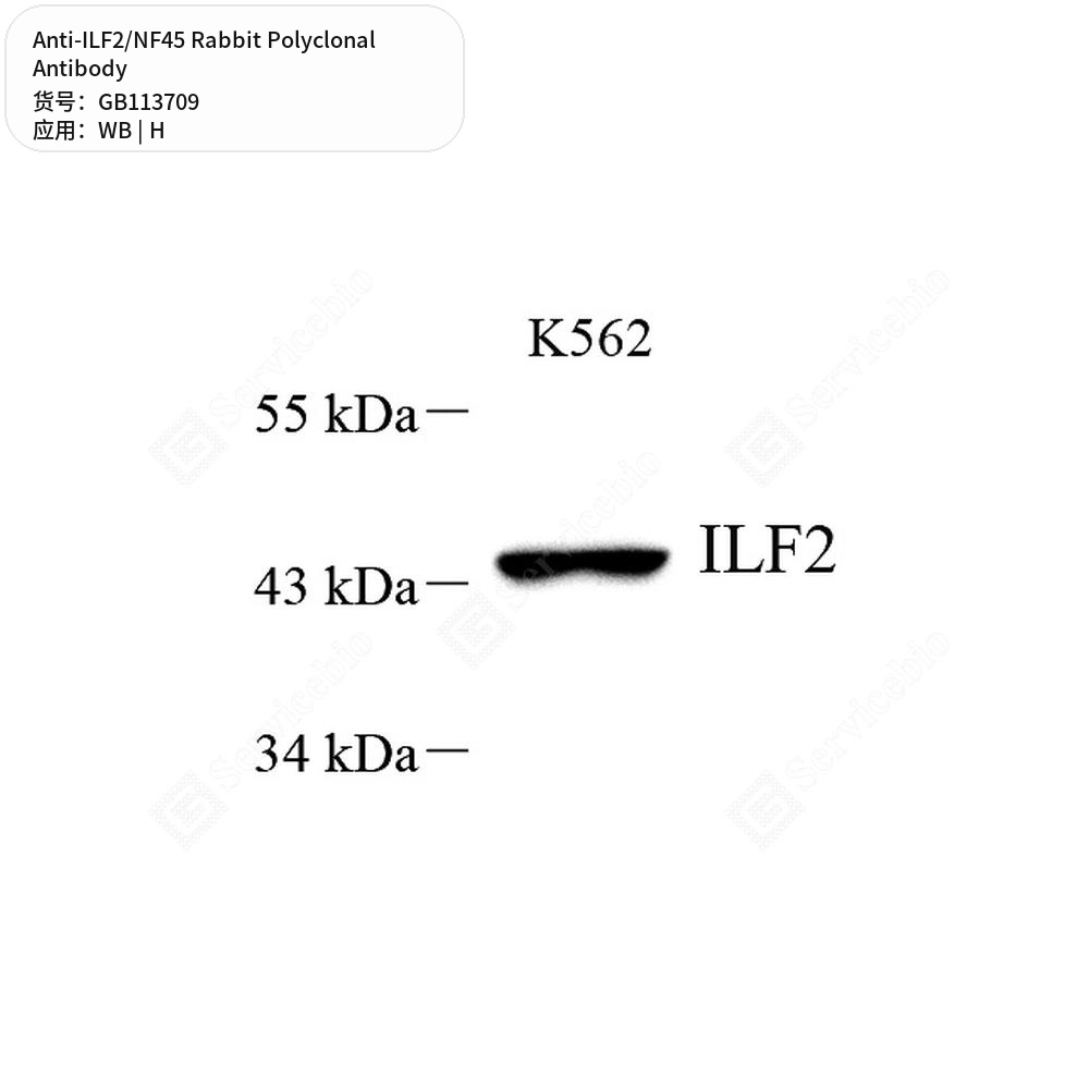 Антитела первичные, поликлональные кролика к ILF2/NF45 человека, 50 мкл