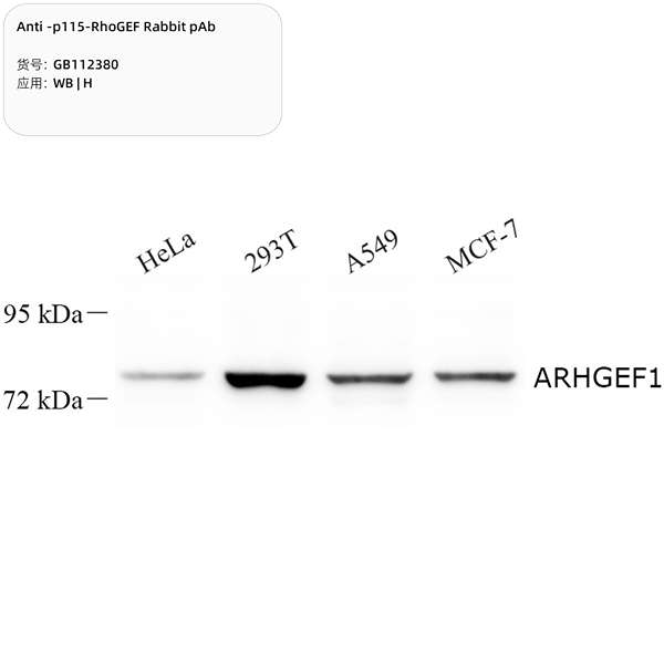 Антитела первичные, поликлональные, p115-RhoGEF, 100 мкл