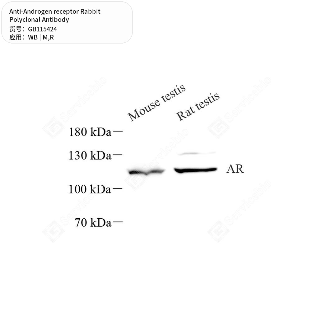 Антитела первичные, поликлональные кролика к Androgen receptor крысы, мыши, 50 мкл