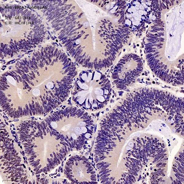 Антитела первичные, поликлональные, BRCA2, 100 мкл