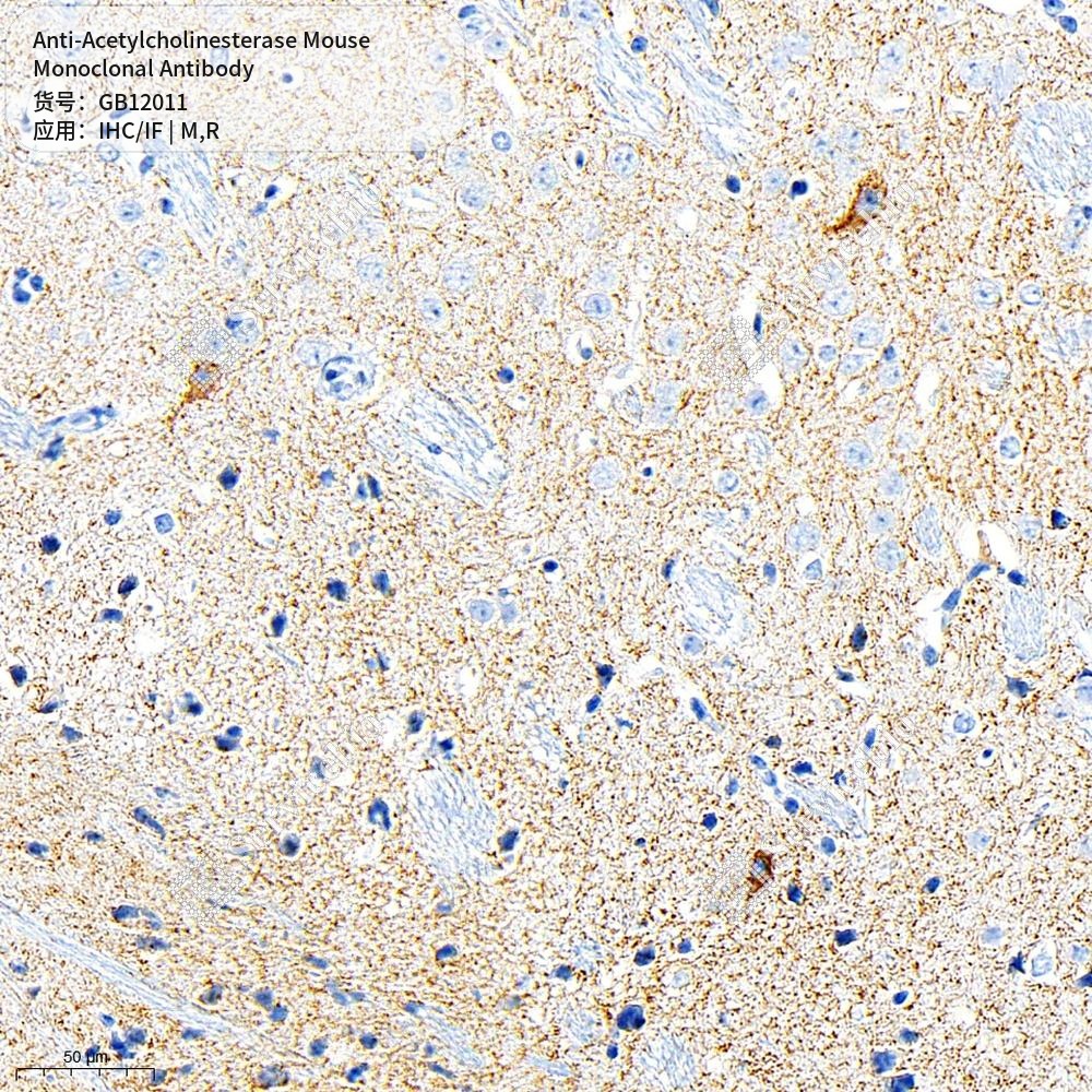 Антитела первичные, моноклональные мыши к Acetylcholinesterase крысы, мыши, 50 мкл