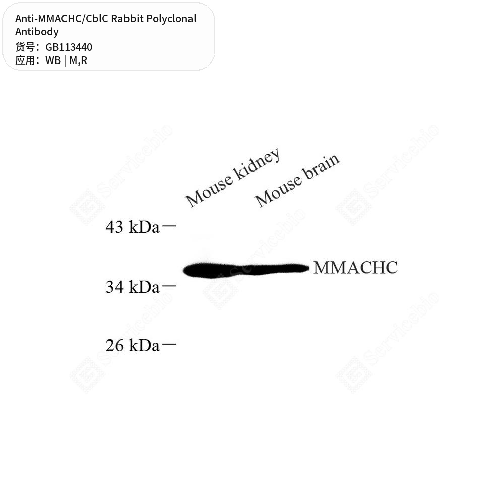 Антитела первичные, поликлональные кролика к MMACHC/CblC крысы, мыши, 100 мкл