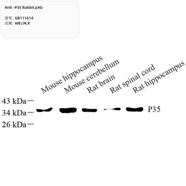 Антитела первичные, поликлональные, P35, 100 мкл