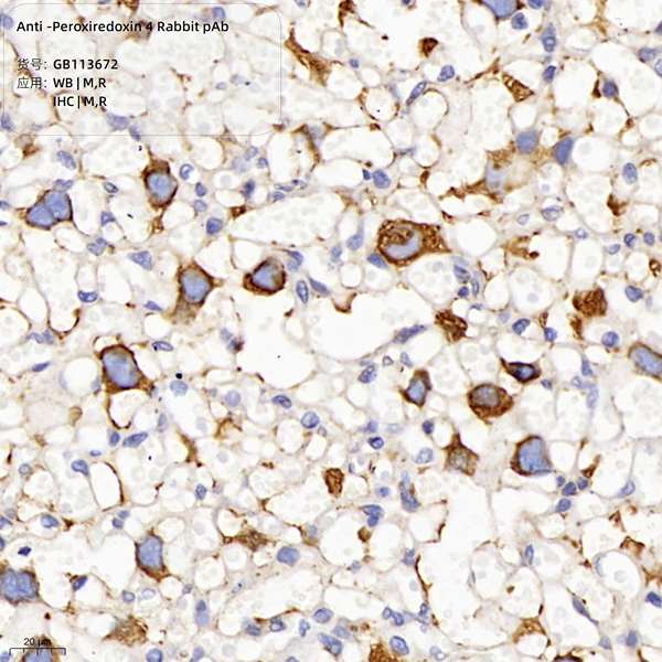 Антитела первичные, поликлональные, Peroxiredoxin 4, 100 мкл