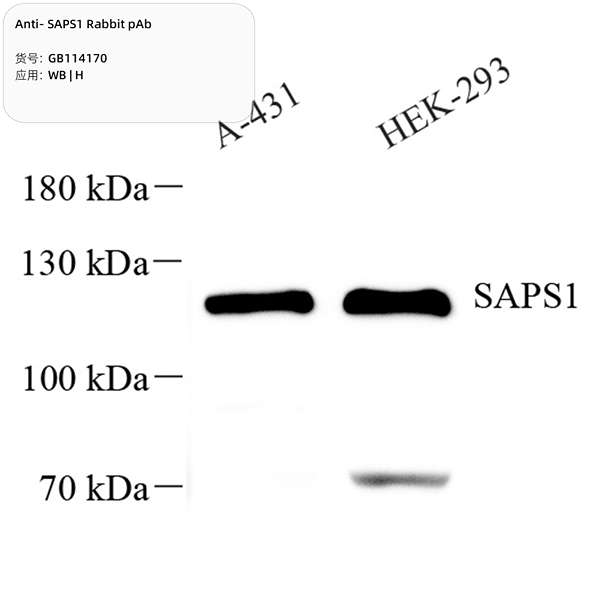 Антитела первичные, поликлональные, SAPS1, 100 мкл