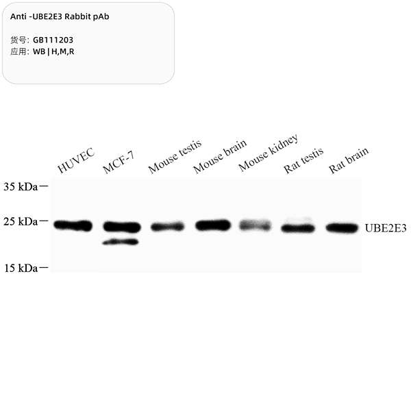 Антитела первичные, поликлональные, UBE2E3, 100 мкл