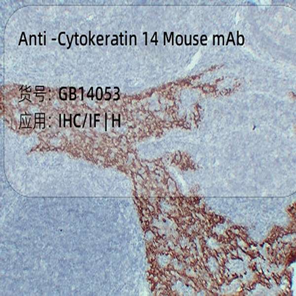 Антитела первичные, моноклональные, Cytokeratin 14, 50 мкл