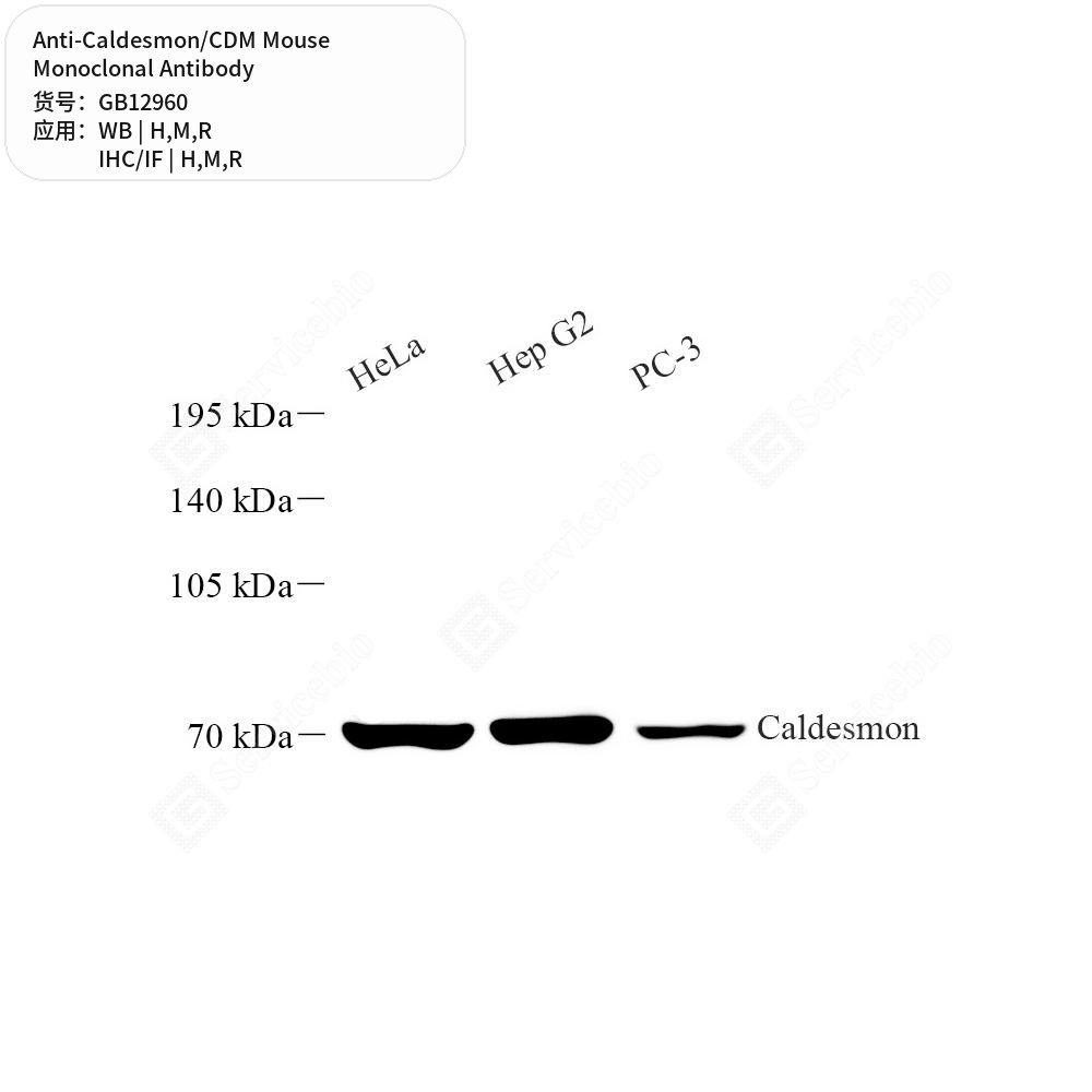 Антитела первичные, моноклональные мыши к Caldesmon/CDM крысы, мыши, человека, 100 мкл