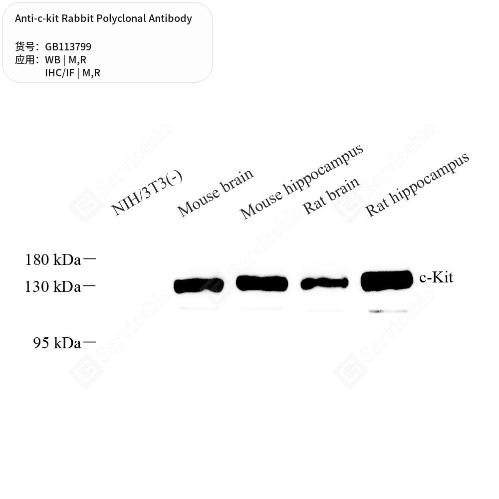 Антитела первичные, поликлональные кролика к c-kit крысы, мыши, 100 мкл
