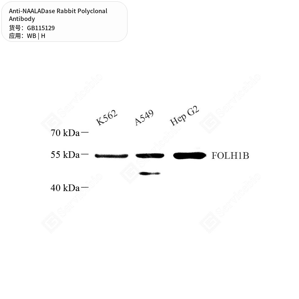 Антитела первичные, поликлональные кролика к NAALADase человека, 50 мкл