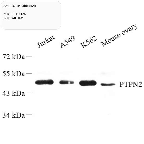 Антитела первичные, поликлональные, TCPTP, 100 мкл