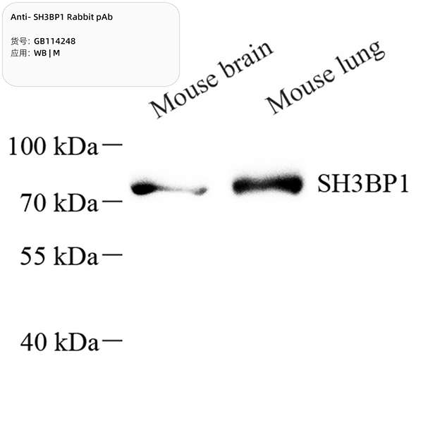 Антитела первичные, поликлональные, SH3BP1, 100 мкл