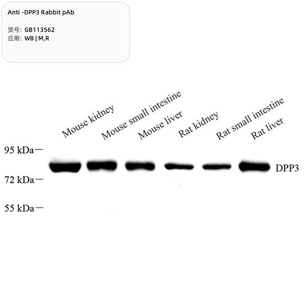Антитела первичные, поликлональные, DPP3, 100 мкл