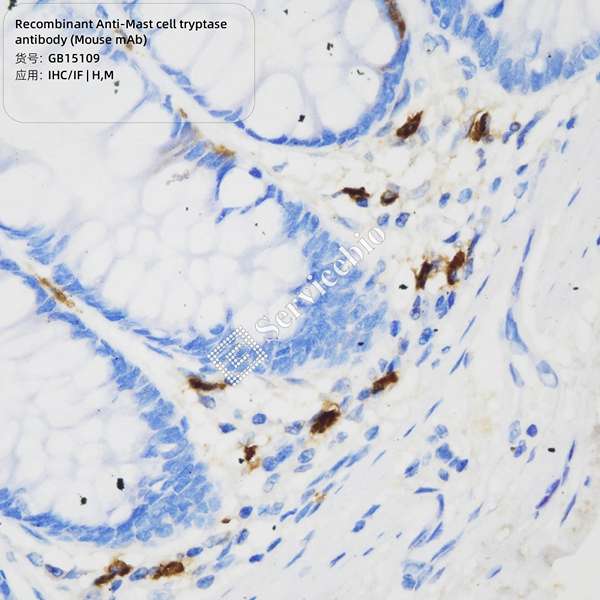 Антитела первичные, моноклональные, Mast cell tryptase, 100 мкл