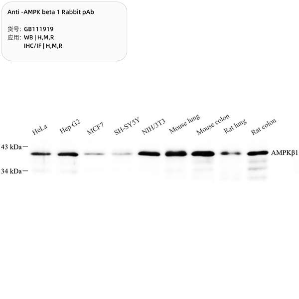 Антитела первичные, поликлональные, AMPK beta 1, 100 мкл