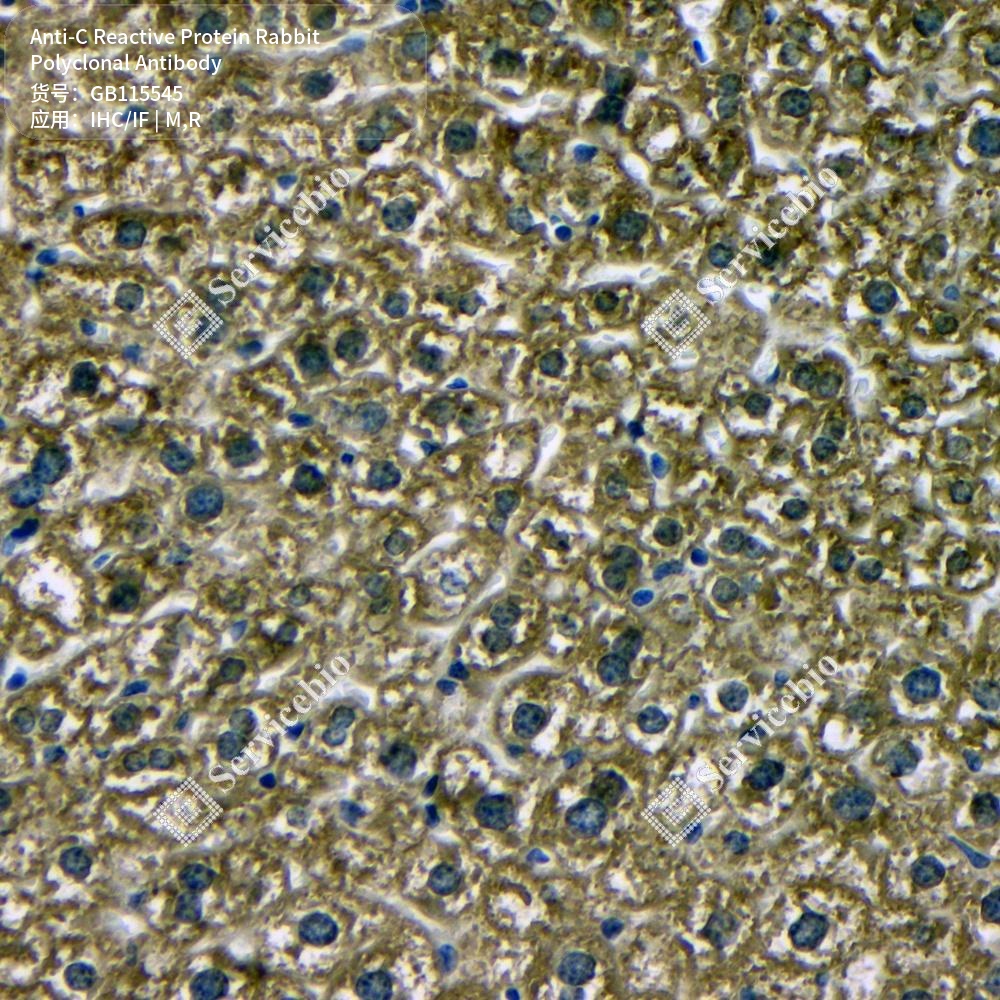 Антитела первичные, поликлональные кролика к C Reactive Protein крысы, мыши, 100 мкл