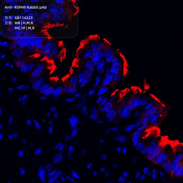 Антитела первичные, поликлональные, RSPH9, 100 мкл
