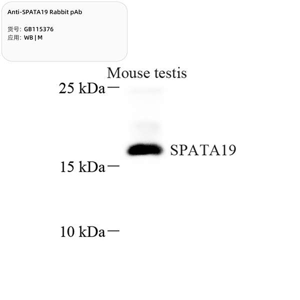 Антитела первичные, поликлональные, SPATA19, 100 мкл