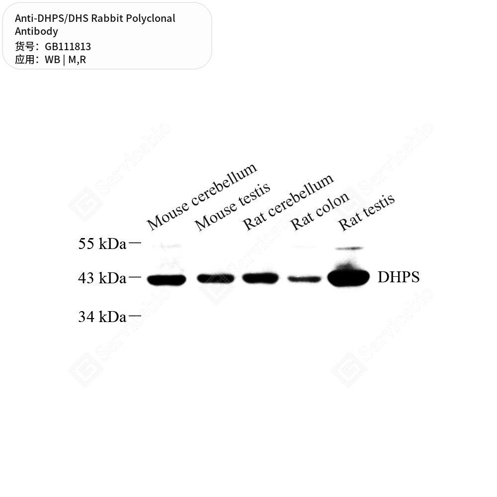 Антитела первичные, поликлональные кролика к DHPS/DHS крысы, мыши, 100 мкл