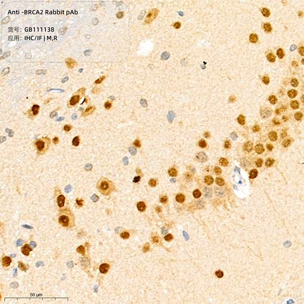 Антитела первичные, поликлональные, BRCA2, 100 мкл