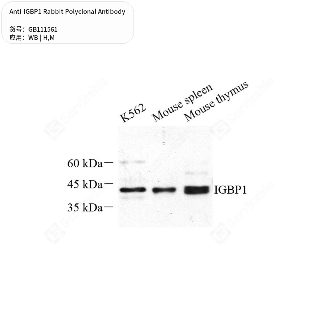Антитела первичные, поликлональные кролика к IGBP1 мыши, человека, 100 мкл