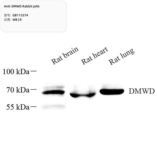 Антитела первичные, поликлональные, DMWD, 100 мкл