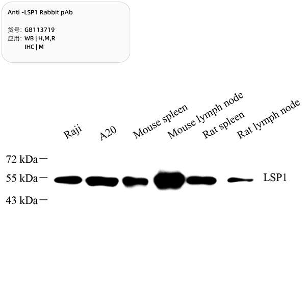 Антитела первичные, поликлональные, LSP1, 100 мкл