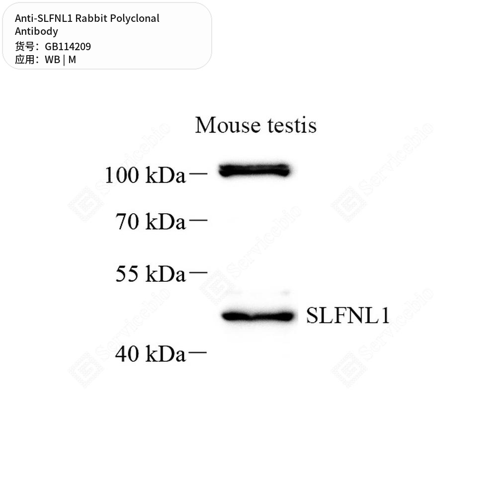 Антитела первичные, поликлональные кролика к SLFNL1 мыши, 100 мкл