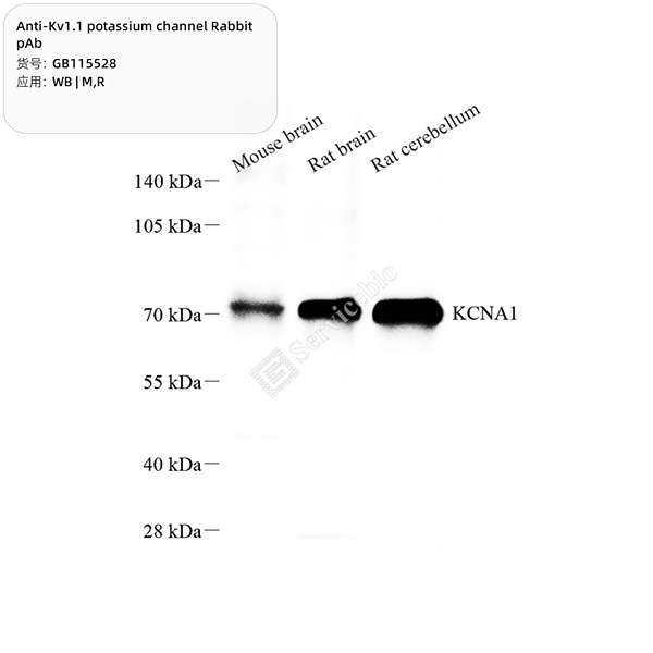Антитела первичные, поликлональные, Kv1.1 potassium channel, 100 мкл