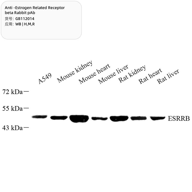 Антитела первичные, поликлональные, Estrogen Related Receptor beta, 100 мкл