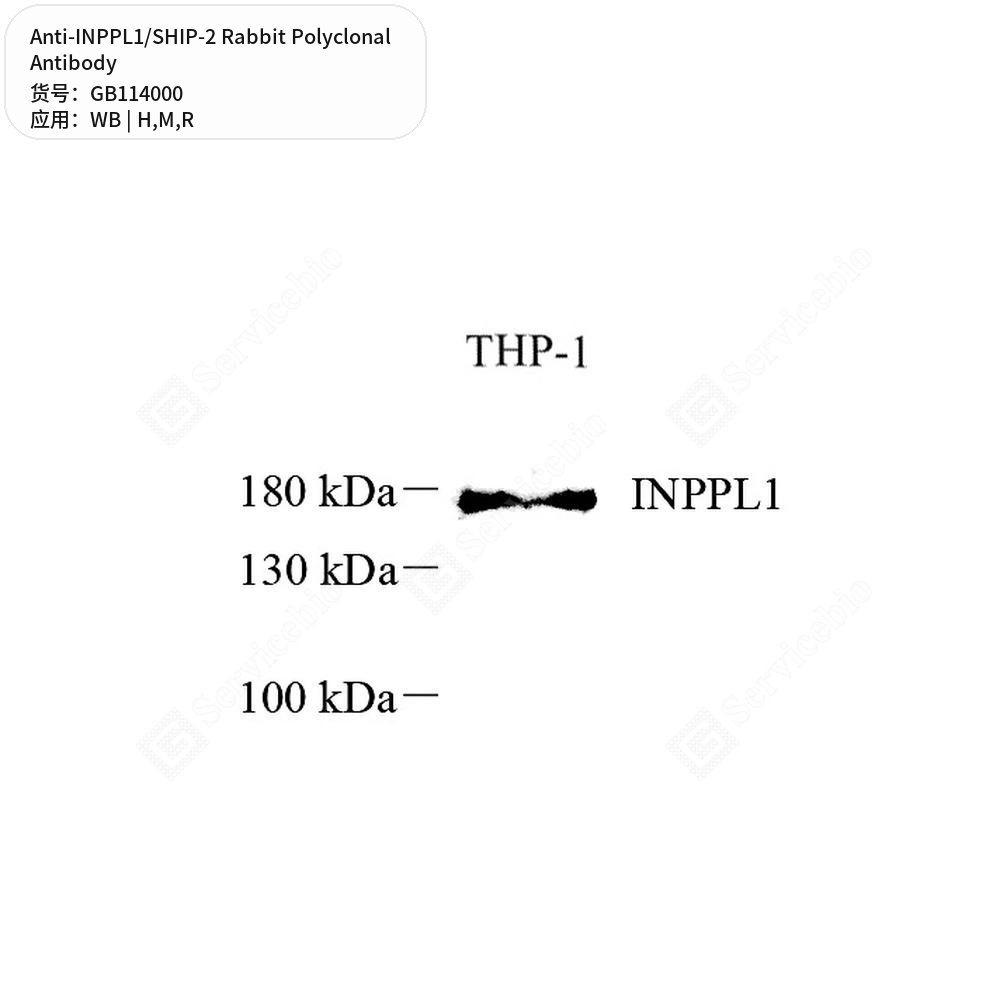 Антитела первичные, поликлональные кролика к INPPL1/SHIP-2 крысы, мыши, человека, 100 мкл