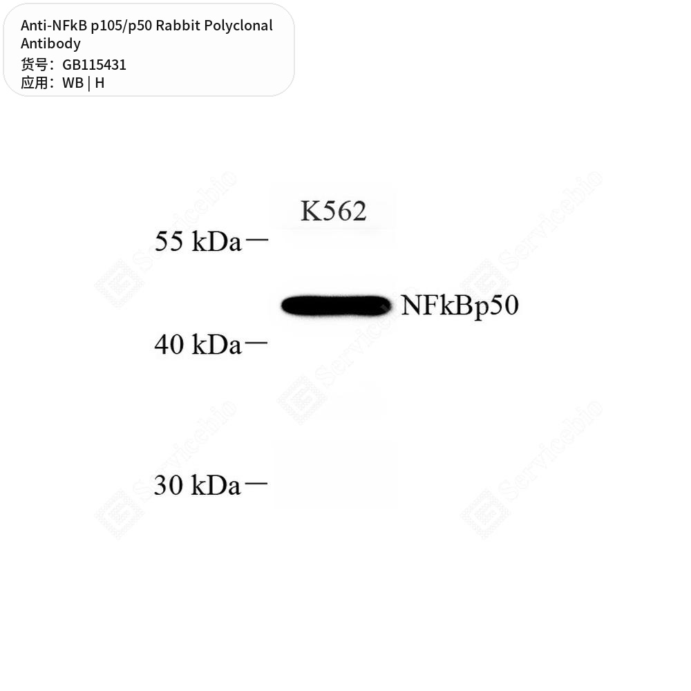 Антитела первичные, поликлональные кролика к NFkB p105/p50 человека, 50 мкл