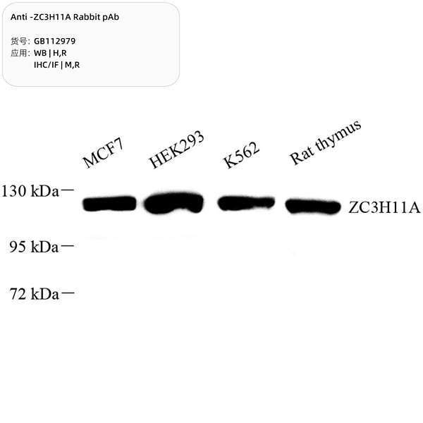 Антитела первичные, поликлональные, ZC3H11A, 100 мкл