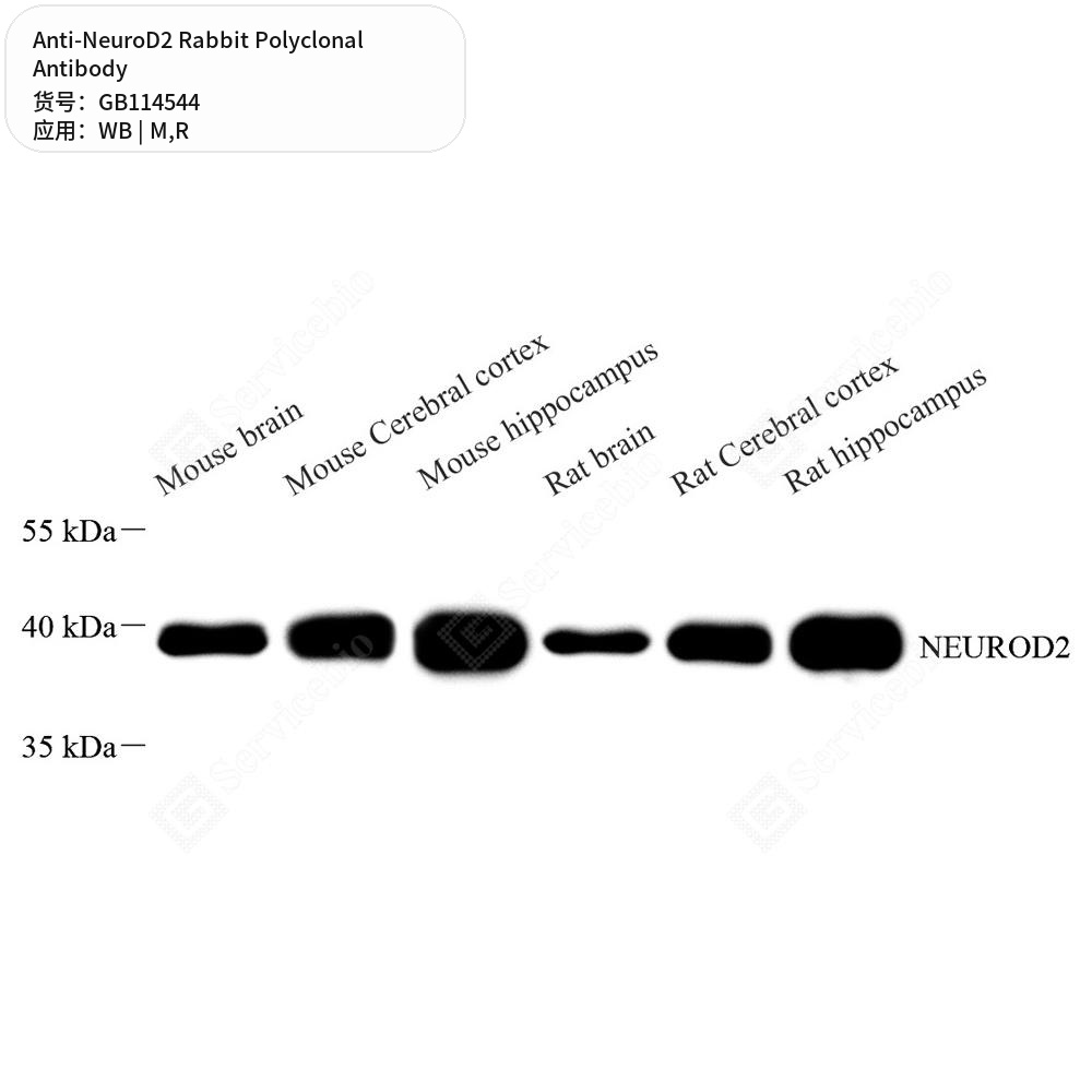 Антитела первичные, поликлональные кролика к NeuroD2 крысы, мыши, 100 мкл