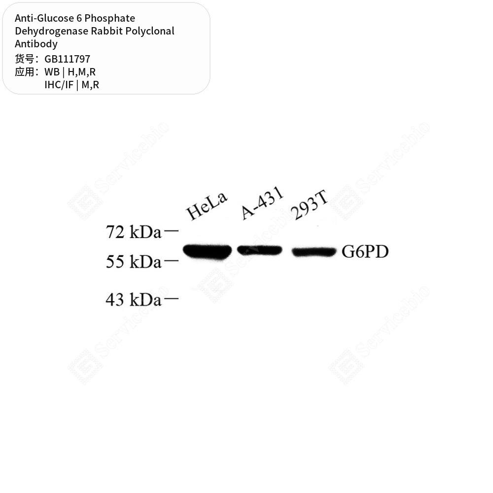 Антитела первичные, поликл. кролика к Glucose 6 Phosphate Dehydrogenase крысы, мыши, чел., 100 мкл