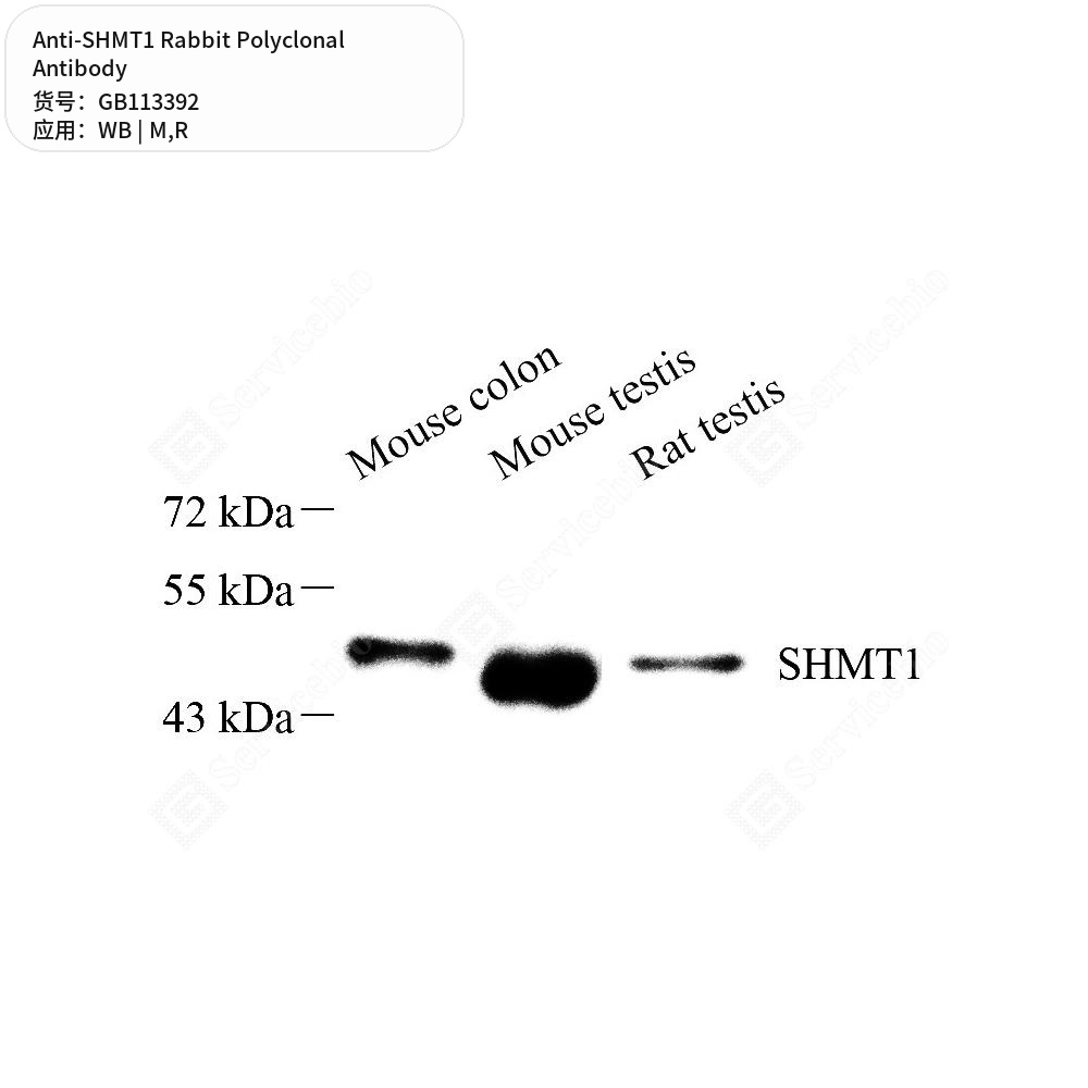 Антитела первичные, поликлональные кролика к SHMT1 крысы, мыши, 100 мкл
