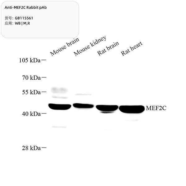 Антитела первичные, поликлональные, MEF2C, 100 мкл