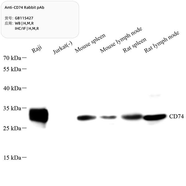 Антитела первичные, поликлональные, CD74, 100 мкл