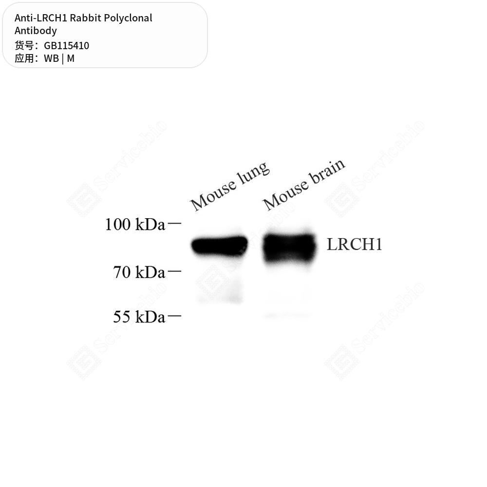 Антитела первичные, поликлональные кролика к LRCH1 мыши, 50 мкл
